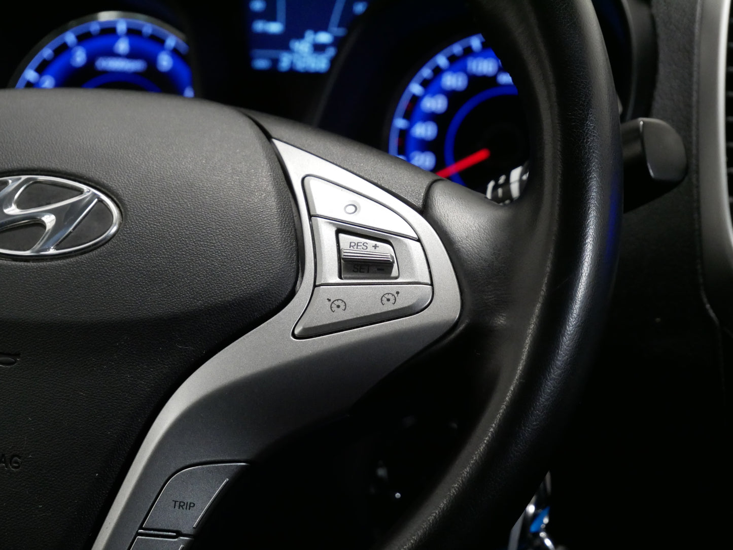Hyundai ix20 1.6 CVVT 92 kW Trikolor Club